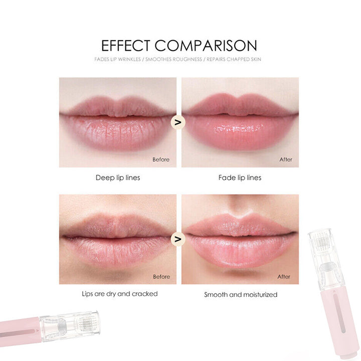 Lip Booster Active MicroRoller 105: Moisturizing & Brightening Lip Enhancement Tool